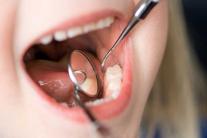 Gum Disease Treatment in Edmonton, AB